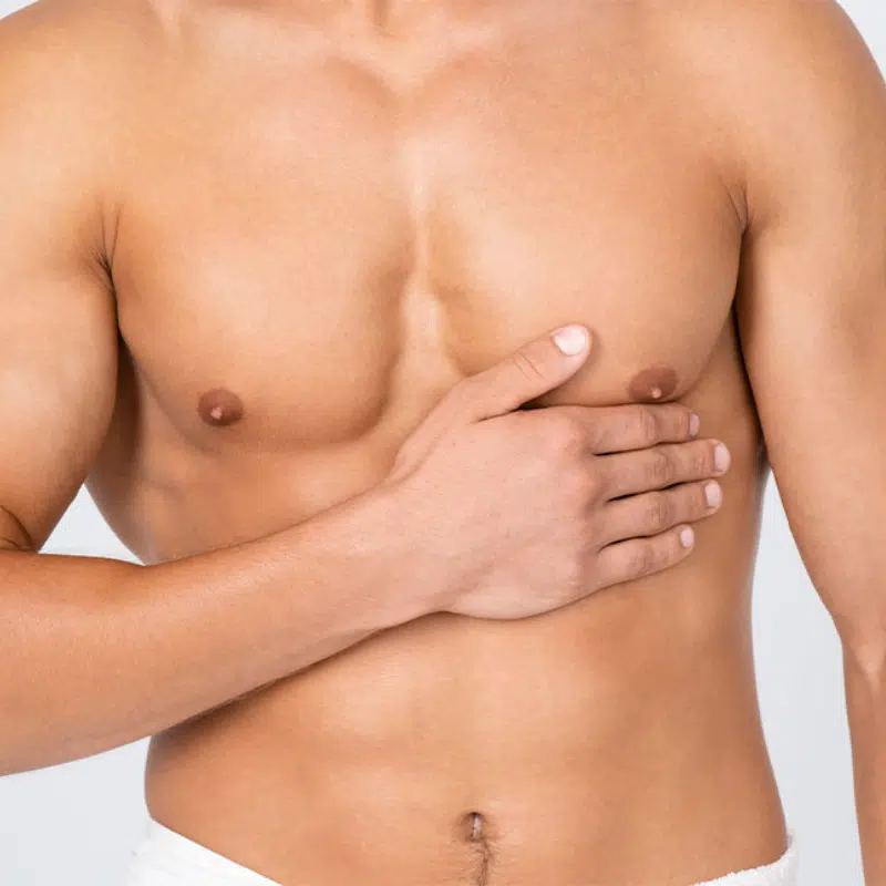 Ginecomastia Dr Henry Sequeira