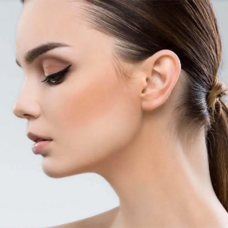 otoplastia Dr Henry Sequeira